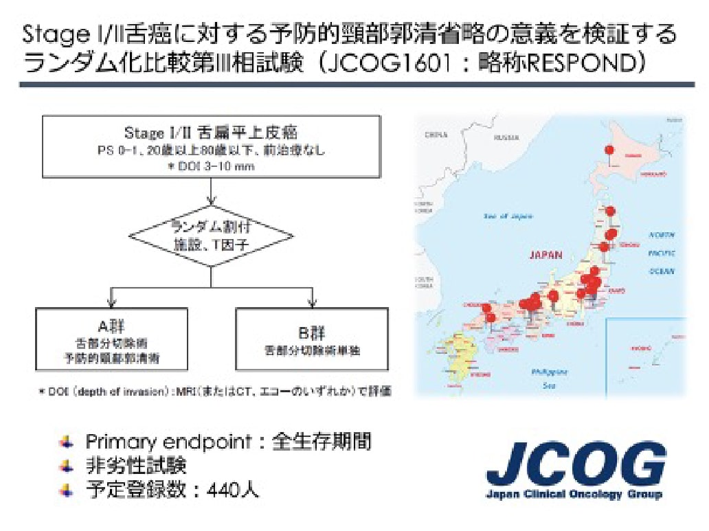 Stage 1/2舌癌に対する予防的頸部郭清省略の意義を検証するランダム化第3相試験(JCOG1601:略称RESPOND)